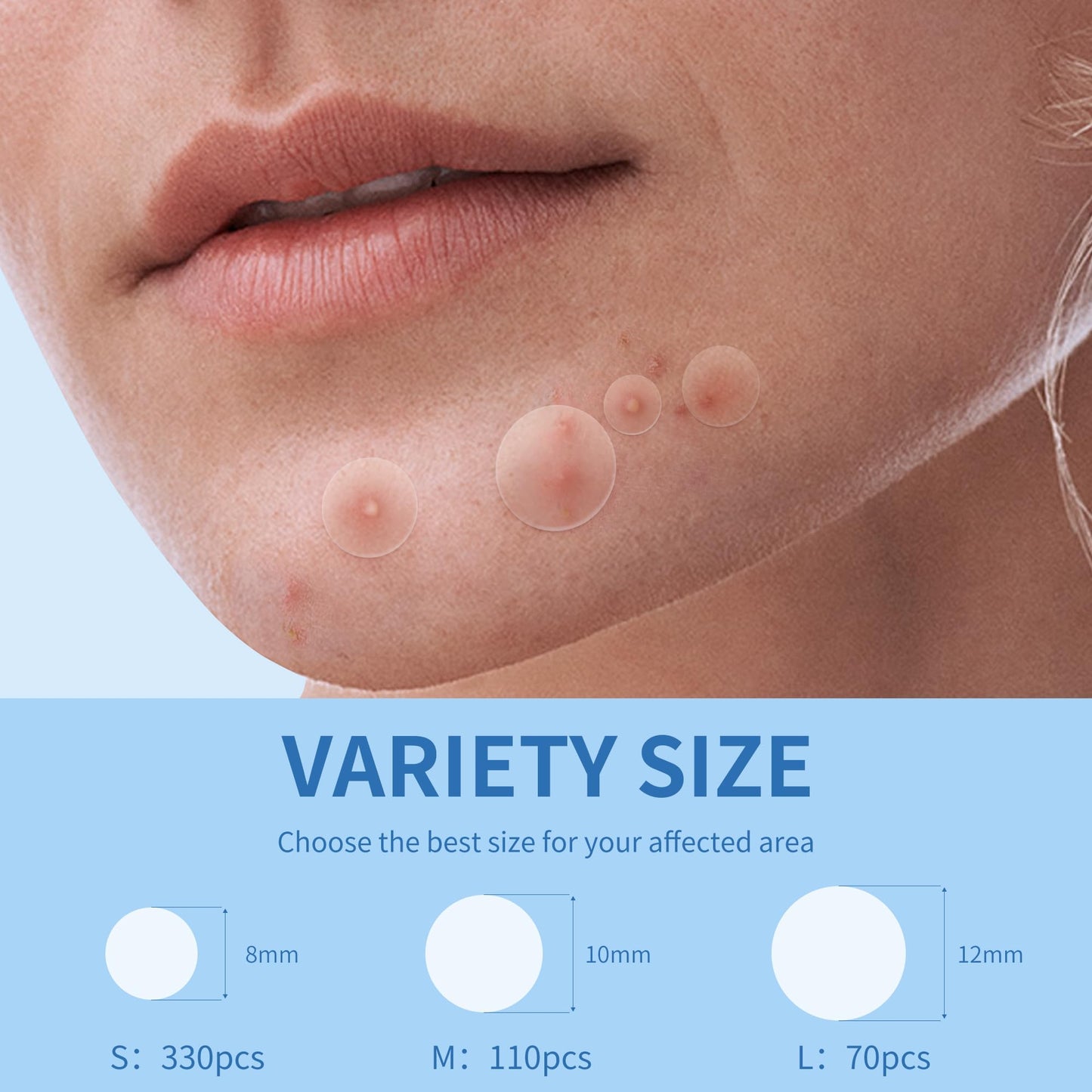 Pimple Patches for Face, 4 Size 300 Counts Acne Patches, Hydrocolloid Patches for Covering Zits and Blemishes, Spot Stickers with Salicylic Acid, Tea Tree Oil & Calendula Oil