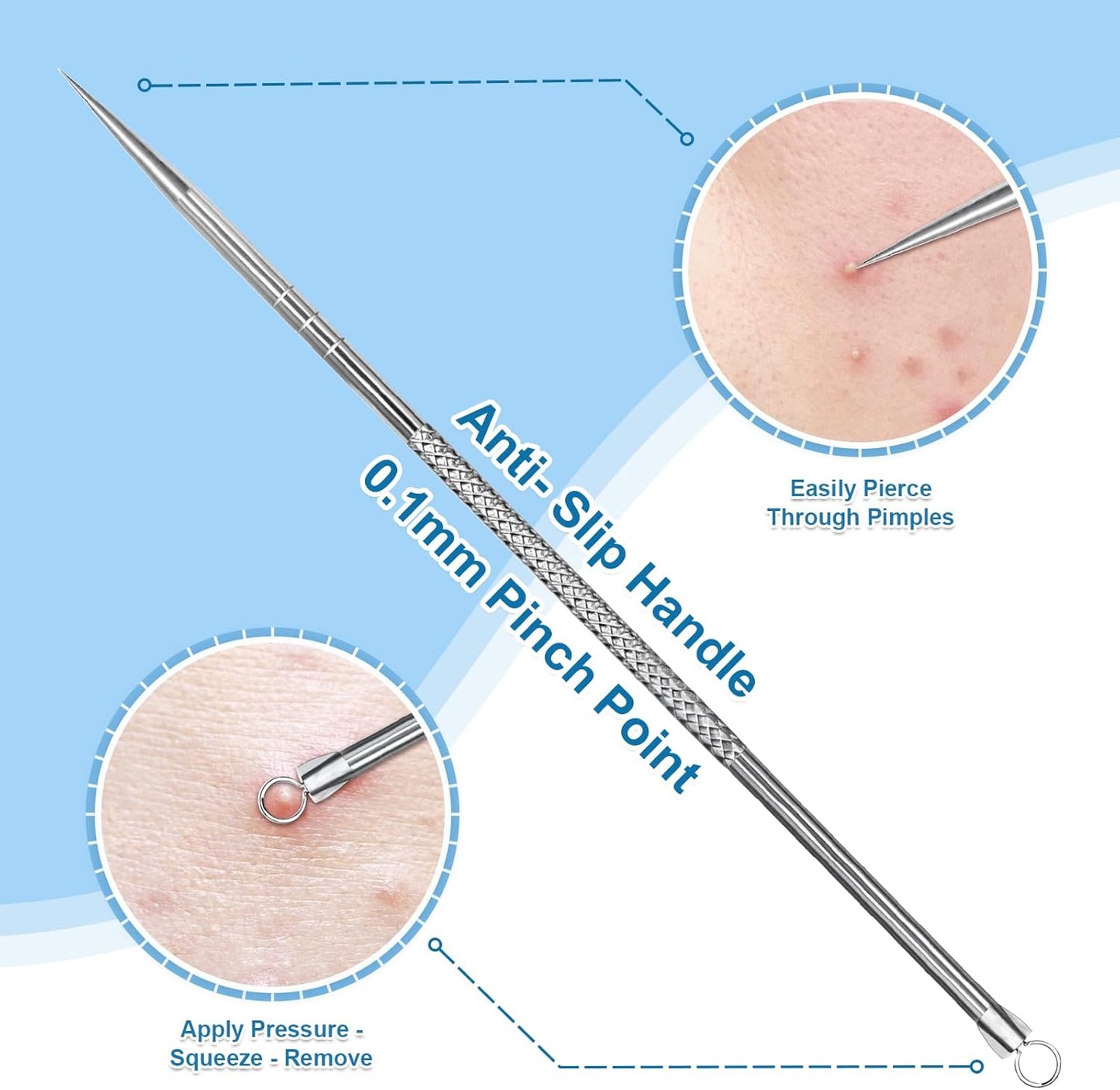Stainless Steel Blackhead Remover, Pimple Extractor, Pimple Popper, Comedone Extractor, Surgical Grade Acne Treatment Tool, 3rd Generation Blemish Removal Kit for Face, Nose, T-Zone, 2Pcs