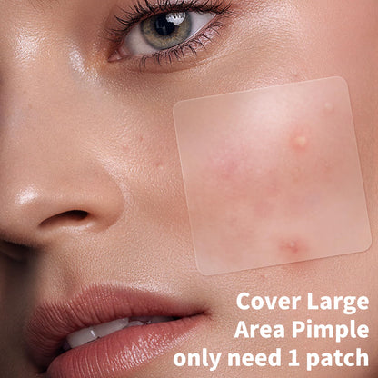 Pimple Patches for Face, 4 Size 300 Counts Acne Patches, Hydrocolloid Patches for Covering Zits and Blemishes, Spot Stickers with Salicylic Acid, Tea Tree Oil & Calendula Oil